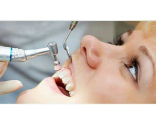 Limpieza_Dental__58bf285bdd2f7