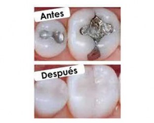 Restauracion_con_58bf3a6f9521f